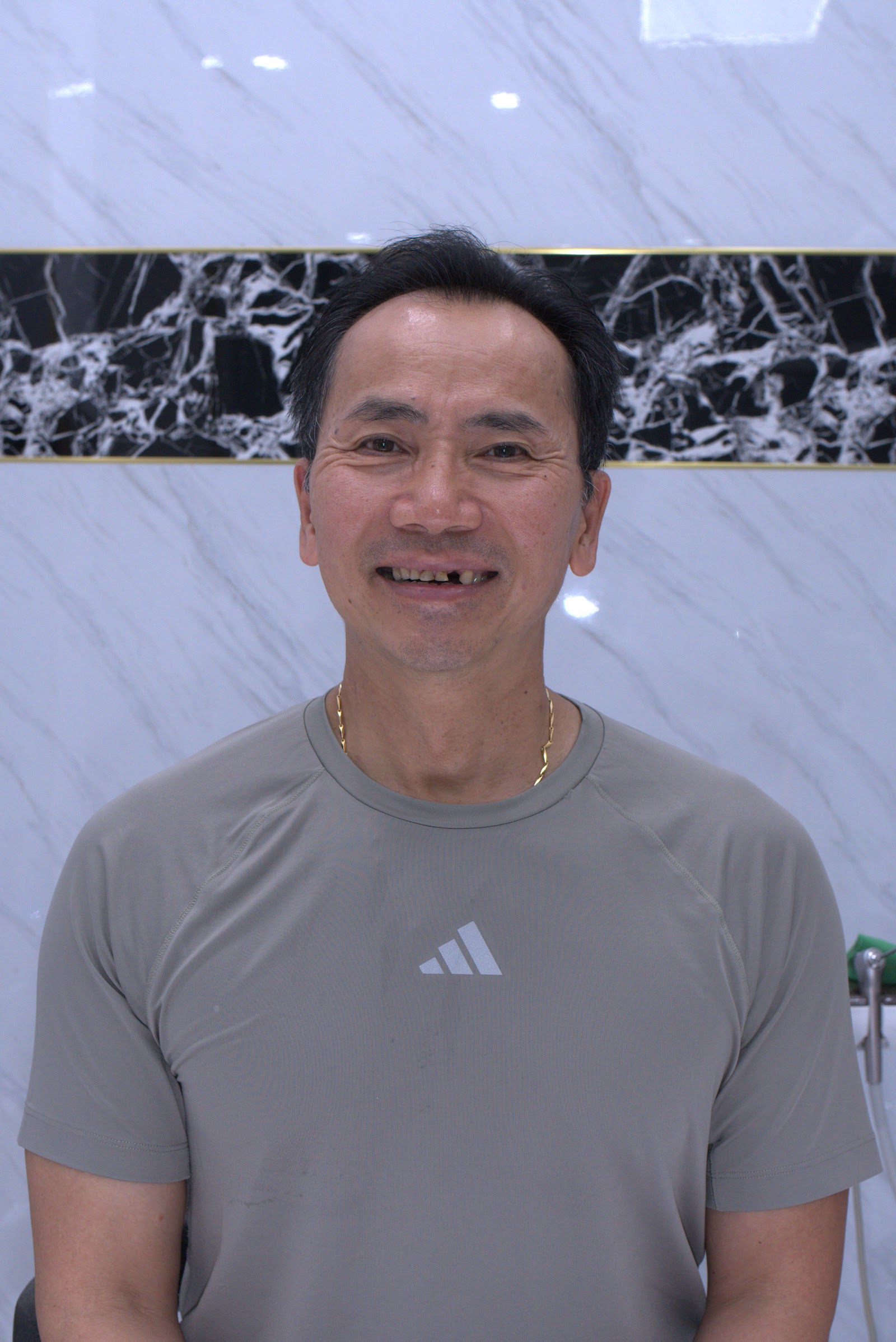 Trước khi điều trị
